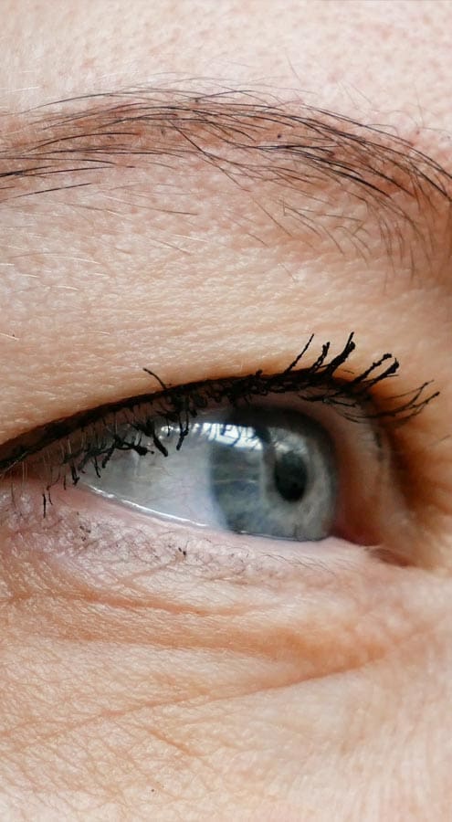 HR Plastic Sugery - Droopy eyelids - Eyelid bags - Loose excess eyelid skin